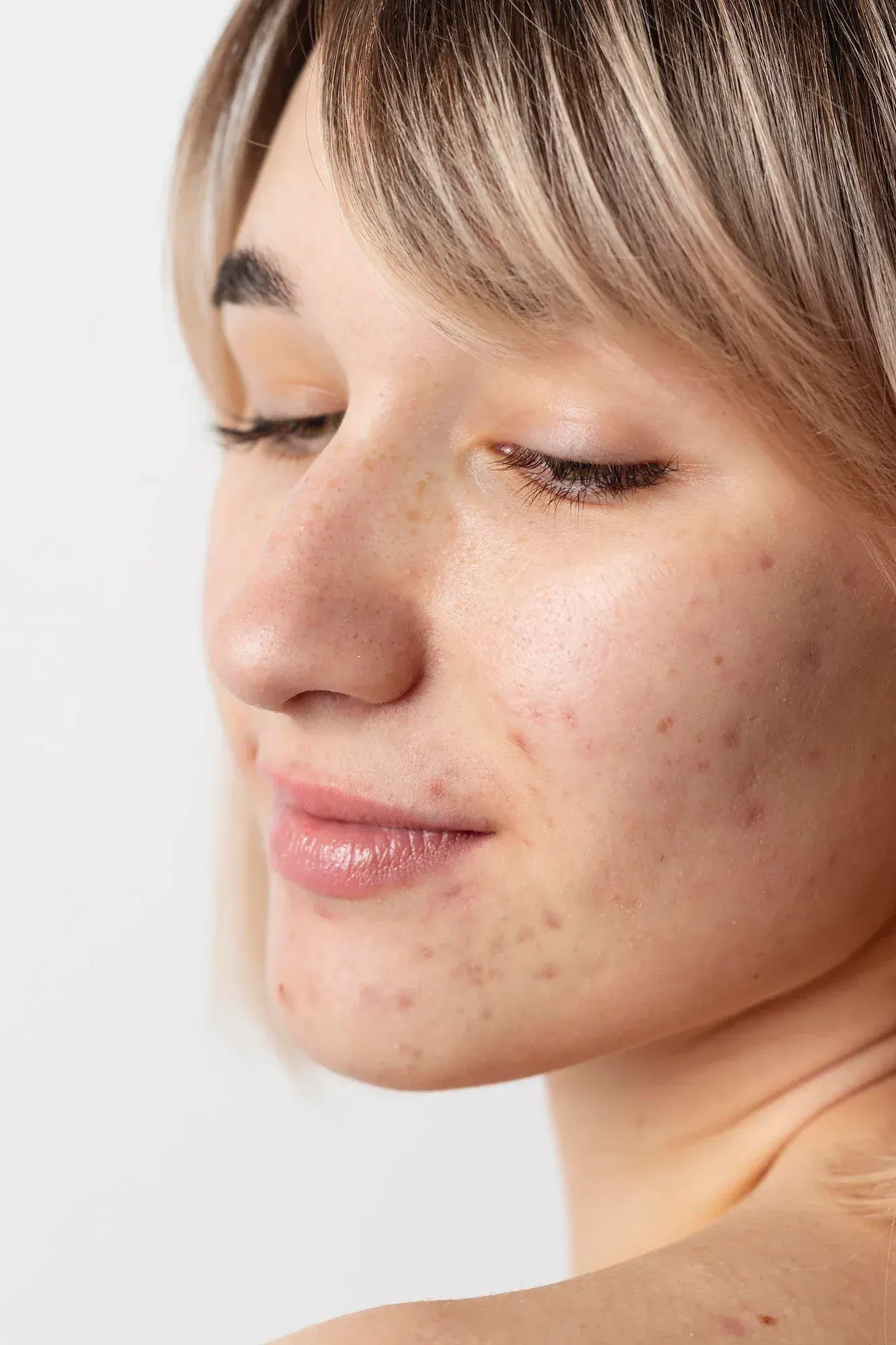 Signs You May Have Hormonal Imbalance