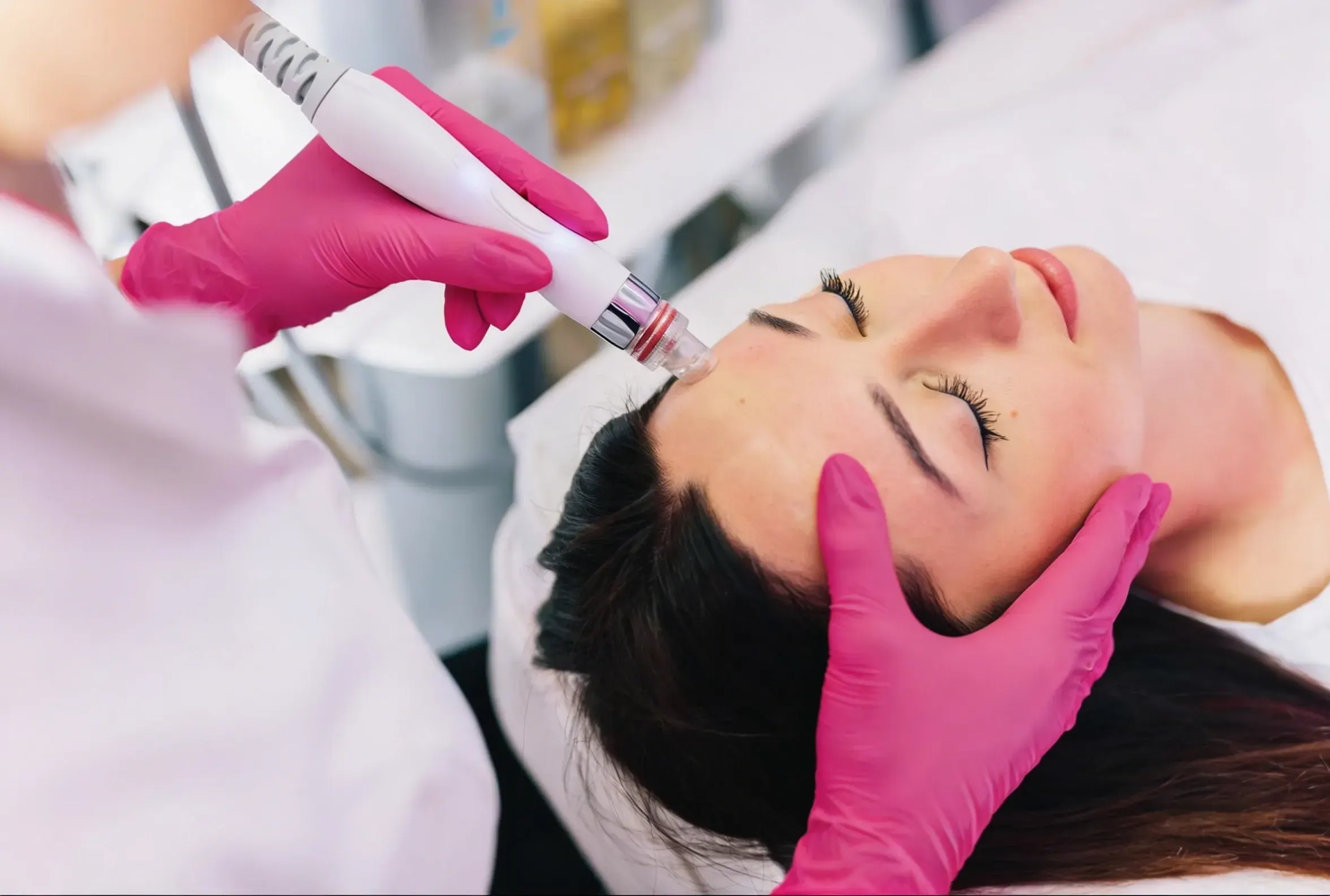 Benefits of Microneedling